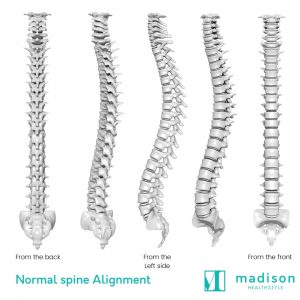 normal spine alignment